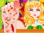Princess Foot kirurgi